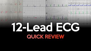 Quick Review of ECGs [upl. by Norina]