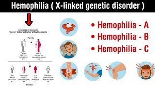 Hemophilia  Xlinked genetic disorder l types and symptoms of hemophilia in Hindi [upl. by Nmutua]