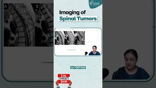 Imaging of Spinal Tumors By Dr Zainab Vora  Radiology Residency  Conceptual Radiology [upl. by Lertnahs]