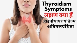 Thyroidism symptoms  low thyroid and high thyroid symptoms [upl. by Triny]