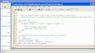 Signal Analysis using Matlab  A Heart Rate example [upl. by Ehcor354]