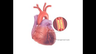 Physical Examination for Patients with Coronary Artery Disease [upl. by Ettessil582]