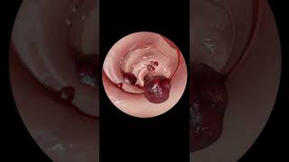 The ULTIMATE Guide to Gastrointestinal Endoscopy  Step by Step Tutorial [upl. by Ahsytal19]