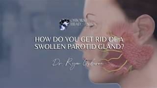 How do you get rid of a swollen parotid gland [upl. by Cymbre685]