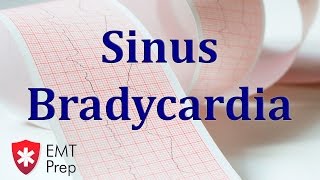 Sinus Bradycardia ECG  EMTprepcom [upl. by Dupin796]