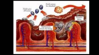 Food Grade Diatomaceous Earth [upl. by Newol263]