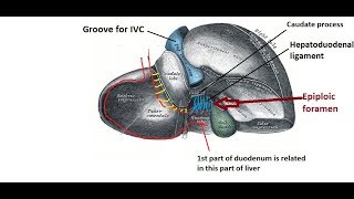 Epiploic foramen  easy and brief description [upl. by Tillio]