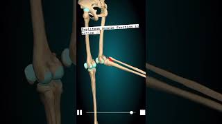 Knee Pain popliteus Release 😨 shorts Squat Injury 😳 [upl. by Parthinia877]