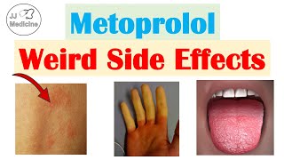 Metoprolol amp Beta Blockers Weird Side Effects Skin Gastrointestinal Psychological [upl. by Trebbor731]