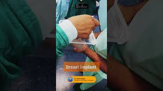 Breast Augmentation Breast Implants Surgery at Dr Sahil Singla [upl. by Sidman]