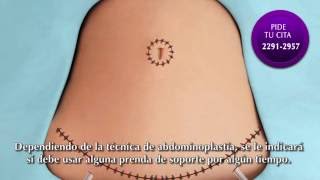 Abdominoplastia  Clínica Thüel [upl. by Verena]