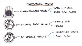 Prosthetic Heart Valves Visual Explanation for Students [upl. by Agace]