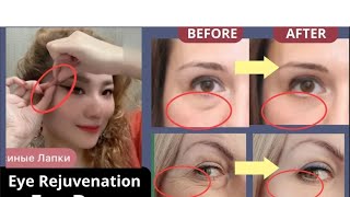 ANTIAGING FACE EXERCISES FOR EYE BAGS EYE WRINKLES DARK CIRCLES DROOPY EYELIDS [upl. by Teyugn]