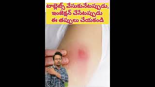 టాబ్లెట్స్ ఇలాగే వేసుకోవాలని తెలియక తప్పు చేశా healthtips doctor medicalprofession paramparik [upl. by Cele809]