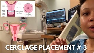 Cerclage Placement Procedure  3  Incompetent Cervix  14 Weeks Pregnant [upl. by Bowe798]