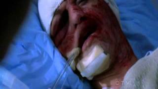 Greys Anatomy Season 5 Finale  Meredith finds out about George [upl. by Leirol]