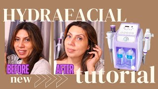 Honest Review  Mychway Hydro Dermabrasion Machine For Home Use Instant Glowing Skin HYDRAFACIAL [upl. by Brigham292]