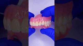 Look at these prostheses Upper acrylic and lower flexible mrdent dentist smile protesisdental [upl. by Nett]