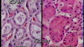 Basic Medical Pathology Morphological Expressions of Cell Injury [upl. by Aneliram]