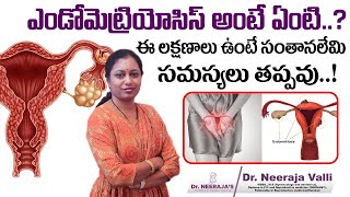 గర్భసంచిలో ఈ వ్యాధి ఉంటే  What is Endometriosis in Telugu  Dr Neerajas Fertility amp Gynaec Center [upl. by Yurt]