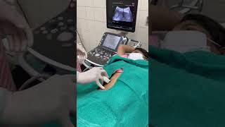 Liver Abscess Aspiration Procedure [upl. by Nightingale]