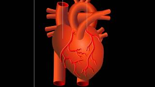 Attaque cardiaque infarctus du myocarde [upl. by Yllop]