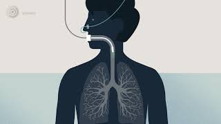 Bronchoscopy  examination of your airways English version [upl. by Anyehs]