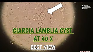 Giardia Lamblia cyst view at 40 XBest microscopic view of giardia cystgiardia parasite in stool [upl. by Trutko]