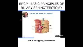 ERCP  Basic Principles of Biliary Sphincterotomy [upl. by Kcuhc24]