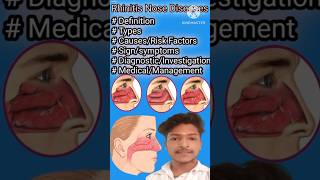 Rhinitis in Hindi  Causes Symptoms and Treatment of Rhinitis  Allergic And Non Allergic Rhinitis [upl. by Sokram26]