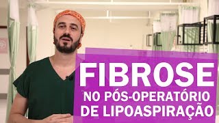 Fibrose no pósoperatório de lipoaspiração [upl. by Caren]