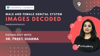 Images Decoded  Ep 9  Male and female genital system  Pathology Images  Dr Preeti Sharma [upl. by Rianna]