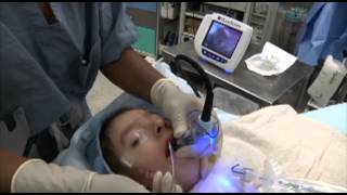 GlideScope Pediatric Airway Rounds Case Study 4 yearold Goldenhar Syndrome [upl. by Horbal]