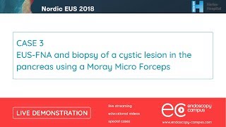 Livedemo  Nordic EUS 2018  EUSFNA and biopsy of a cystic lesion in the pancreas [upl. by Rasecoiluj]