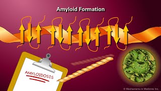 Amyloidosis [upl. by Airom]