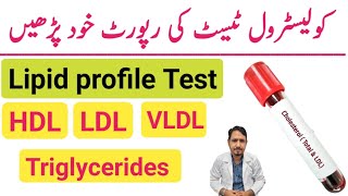 How To Read Cholesterol Test Report Urdu Hindi  Lipid Profile Test  HDL LDL amp Triglycerides Test [upl. by Eednim]