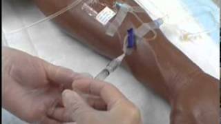 Intravenous IV Therapy Administering IV Medication via a Saline Lock [upl. by Ahsikyt568]