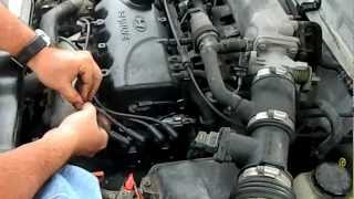 1999 Hyundai Accent Ignition Coil Change Pt 2 [upl. by Yenial234]