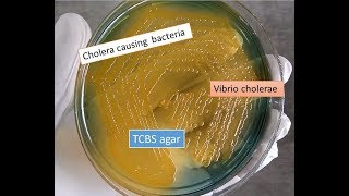 TCBS agar with Vibrio cholerae showing yellow colonies [upl. by Marrissa]