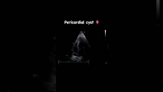 A pericardial cyst in echocardiography 💖 [upl. by Flin]