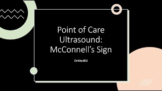 Point of Care Ultrasound POCUS McConnells Sign [upl. by Oniluap]