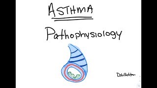 Asthma  Pathophysiology [upl. by Idnac13]