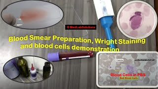 Blood Smear Preparation Wright Staining and blood cells demonstration [upl. by Crichton]