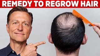 How to Regrow Hair the Two Causes of Hair Loss – Dr Berg [upl. by Inilam622]