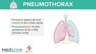 Pneumothorax Definition Types and classification Preview [upl. by Domini]