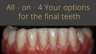 Full Mouth Dental Implants Cost and Comparison [upl. by Atidnan]