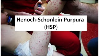 HenochSchonlein Purpura HSP [upl. by Mathew]