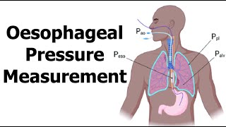 Oesophageal Pressure Measurement [upl. by Ganiats980]