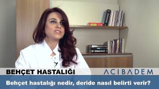 Behçet hastalığı nedir deride nasıl belirti verir [upl. by Nairoc]