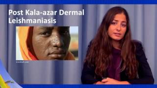 Treatment and Prevention  Leishmaniasis [upl. by Tiemroth]